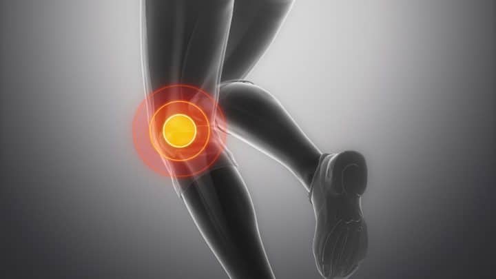 Dlhodobé preťaženie kolena, či už pri práci alebo pri športe, môže viesť k postupnému poškodzovaniu menisku.